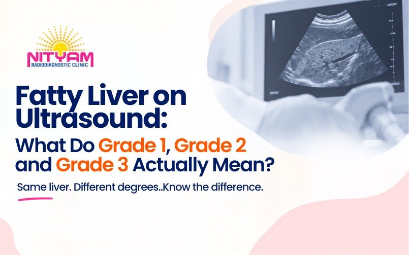 What do Grade 1, 2, and 3 fatty liver on ultrasound actually mean? Nityam Radiodiagnostic Clinic explains hepatic steatosis, liver health, and next steps.